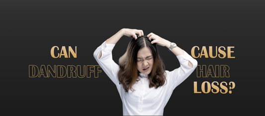 Can Dandruff Cause Hair Loss