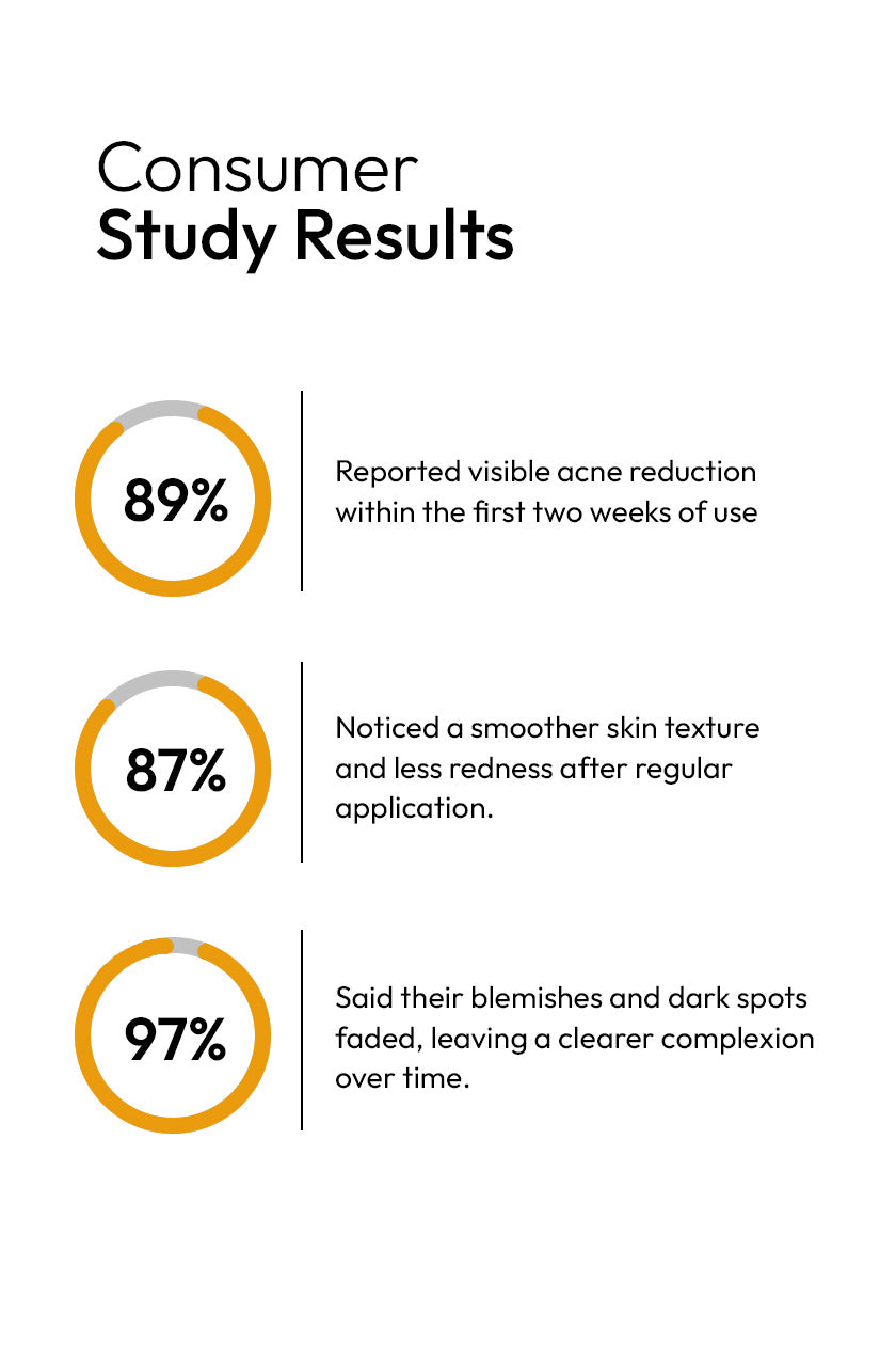 ANTI ACNE SERUM (30ml) (GURANTEED RESULTS IN 7-DAYS)