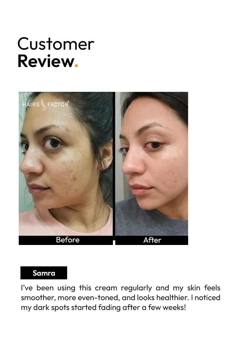 NATURAL NIGHT SKIN WHITENING CREAM (GURANTEED RESULTS)