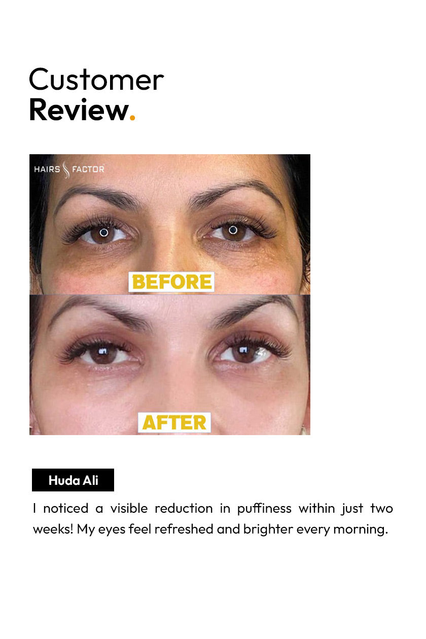 Under Eye Serum for Dark Circles (Results in 15 days)