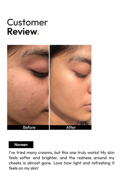 Tea Tree Whitening Cream