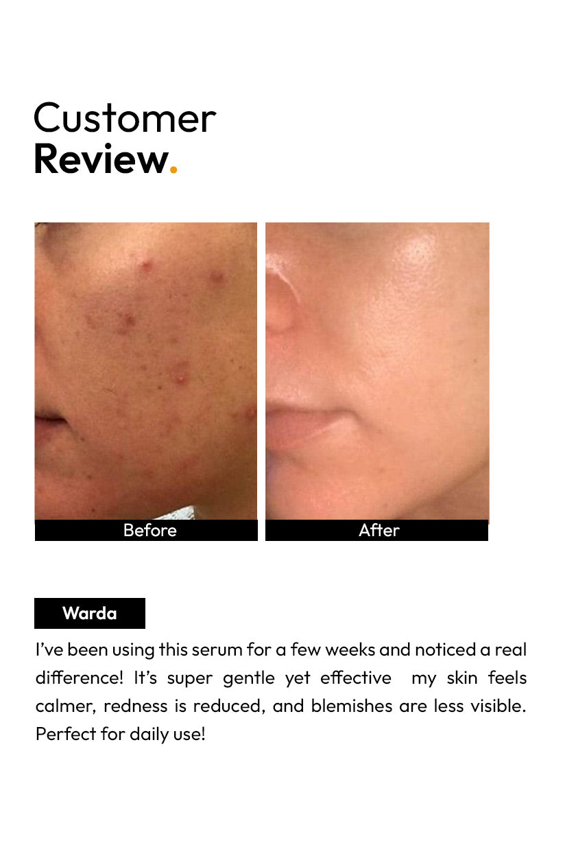 Tea Tree Face Serum for cystal clear skin (30ml)