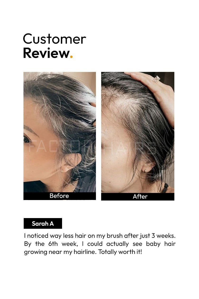 10X HAIR GROWTH SERUM (30ML)