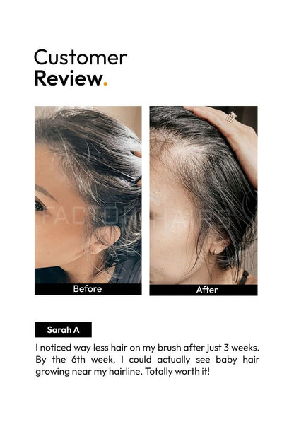 10X HAIR GROWTH SERUM (30ML)