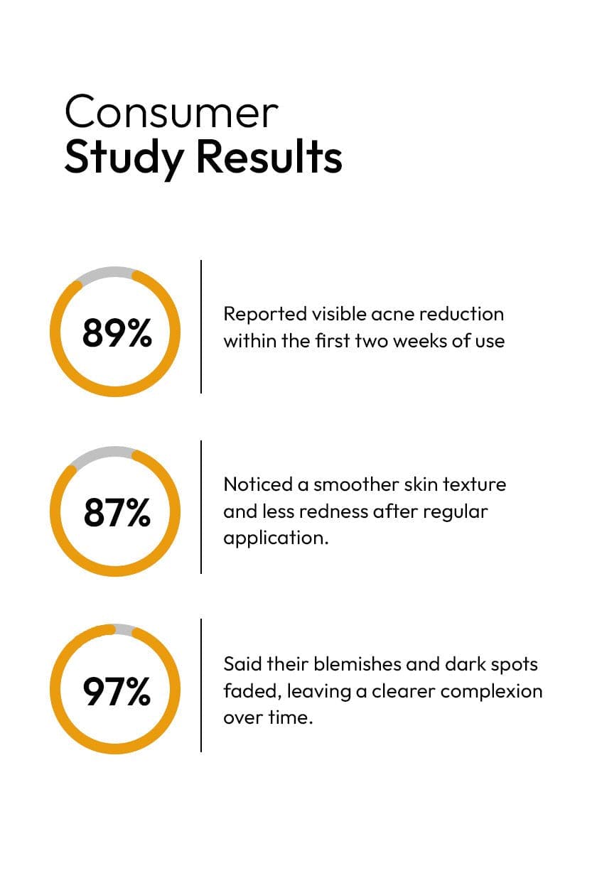 ANTI ACNE SERUM (30ml) (GURANTEED RESULTS IN 14-DAYS)