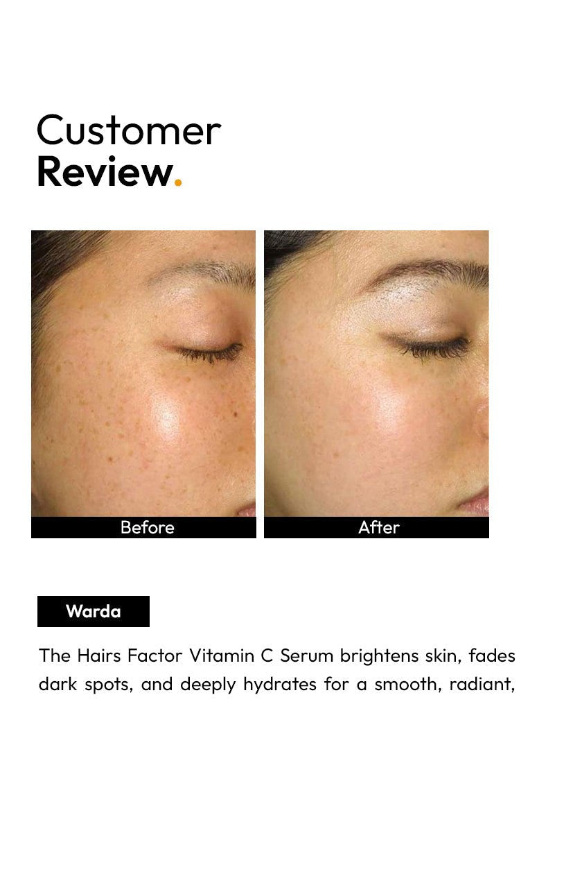 Vitamin C Skin Serum (30ml)