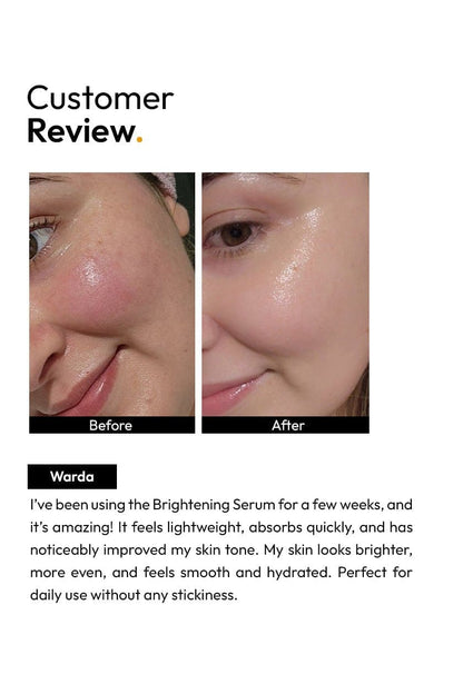 Brightening Face Serum (GURANTEED RESULTS IN 7-DAYS) (30ML)