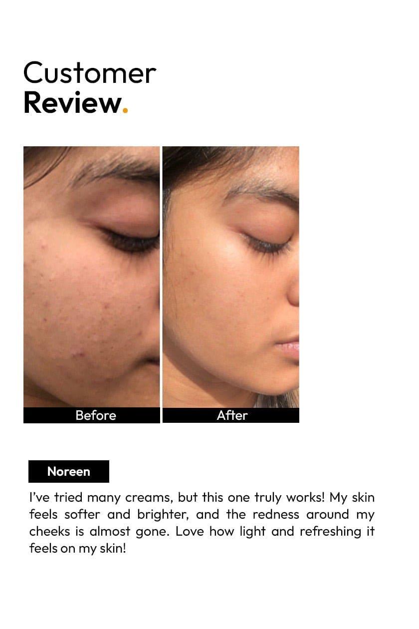 Tea Tree Whitening Cream